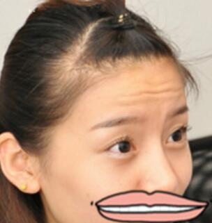 注射瘦臉去抬頭紋果不錯——濟(jì)南吉芙美容整形醫(yī)院