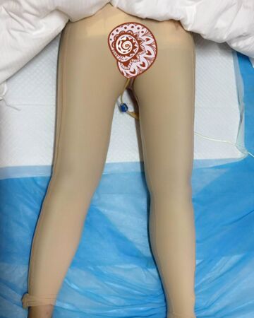 貴陽美萊錢剛大腿抽脂親身經(jīng)歷回憶