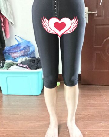 貴陽美萊錢剛大腿抽脂親身經(jīng)歷回憶