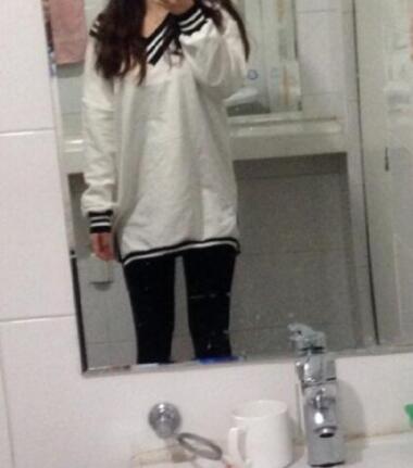 抽脂減肥瘦大腿價格10800元，一個月后恢復很好