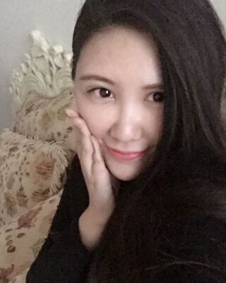 貴陽麗都自體脂肪面部填充+雙下巴吸脂恢復(fù)圖片