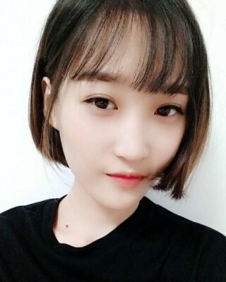 微創(chuàng)全切雙眼皮果對比照片，貴陽麗都葛志鑫手術(shù)案例