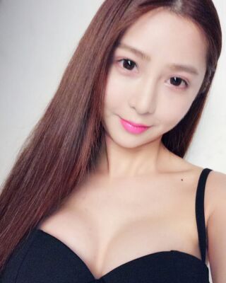 美國曼托假體隆胸手術(shù)果圖，貴陽麗都李觀龍做的