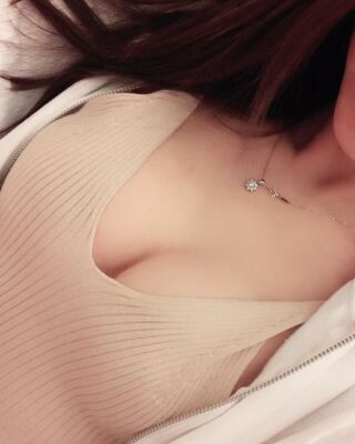 美國曼托假體隆胸手術(shù)果圖，貴陽麗都李觀龍做的