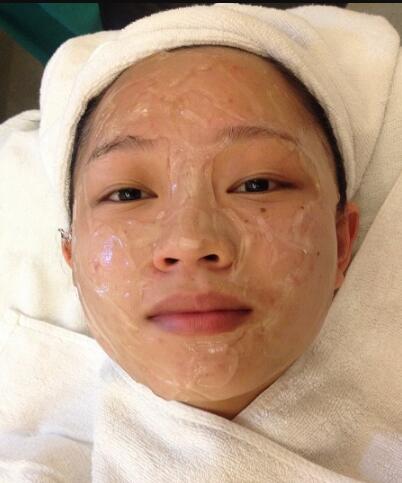 有人做過光子嫩膚嗎？自己做過，感覺果不錯分享