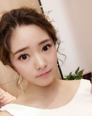 全切微創(chuàng)雙眼皮恢復(fù)圖，長(zhǎng)沙希美蔣松林手術(shù)案例