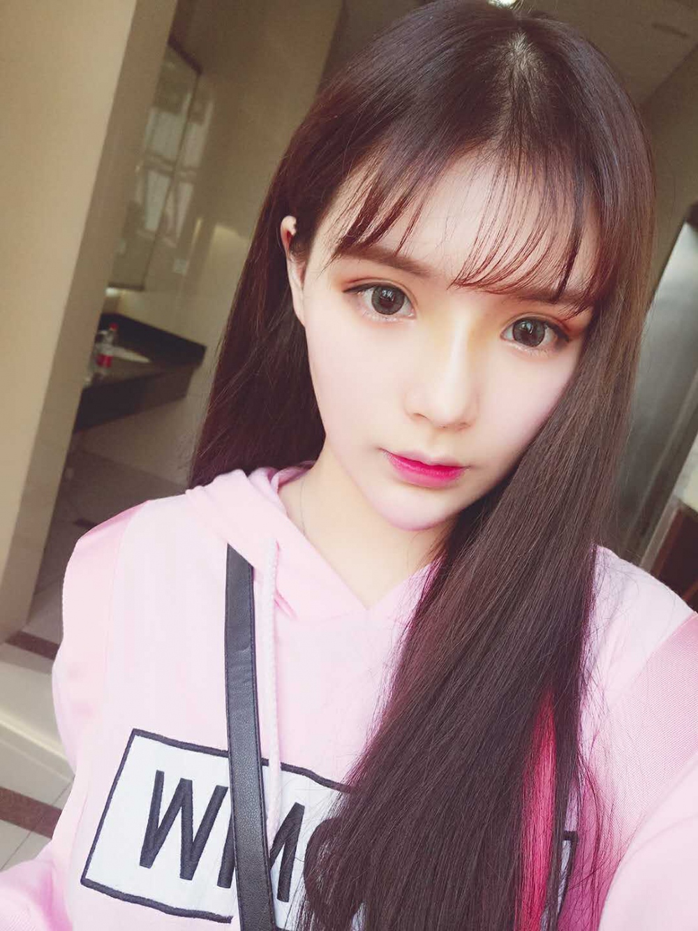 線D隆鼻果好不好，長沙希美真是案例告訴你