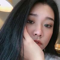 玻尿酸去法令紋前后對比圖分享