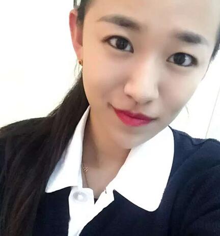 注射瘦臉去抬頭紋眉間紋恢復(fù)過程圖，真實(shí)案例分享