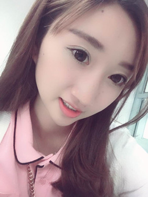 濰坊華美童艷梅醫(yī)生做的面部脂肪填充，大家來看看果怎么樣