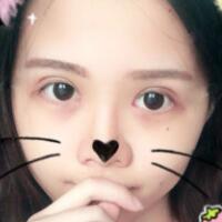 切開雙眼皮+開眼角前后對(duì)比圖和恢復(fù)過程分享