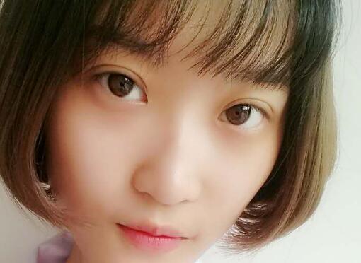 切開雙眼皮多少錢？割雙眼皮真實案例多對比圖分享