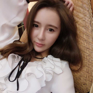 濟(jì)南海峽趙廣生做的自體耳軟骨墊鼻尖+硅膠隆鼻前后對比照片分享