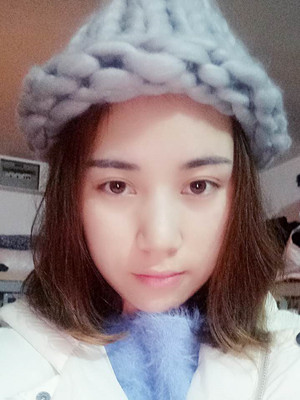 濟(jì)南海峽謝燕燕做的切開雙眼皮，分享前后對(duì)比照片以及恢復(fù)過程