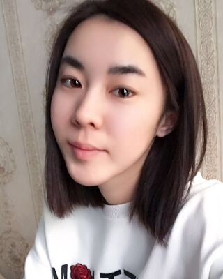 自體脂肪面部填充三個(gè)月果圖分享，減齡十歲