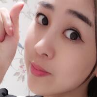 鼻翼縮小手術(shù)對(duì)比圖分享——四川悅好整形