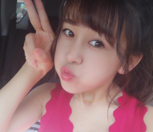 鼻翼縮小手術(shù)對(duì)比圖分享——四川悅好整形