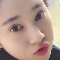 開眼角+割雙眼皮真實(shí)案例前后對(duì)比圖分享——四川悅好整形