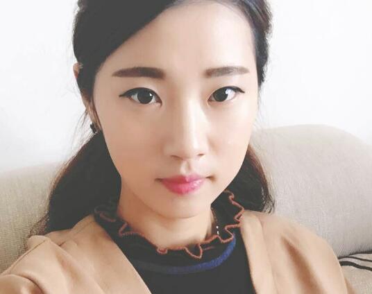 開眼角+割雙眼皮真實(shí)案例前后對比圖分享——四川悅好整形