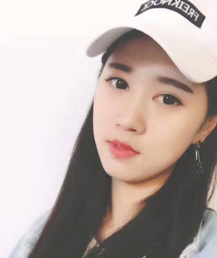 開眼角+割雙眼皮真實(shí)案例前后對比圖分享——四川悅好整形