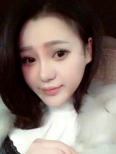 上海九院李圣利隆鼻整形真實恢復期圖片