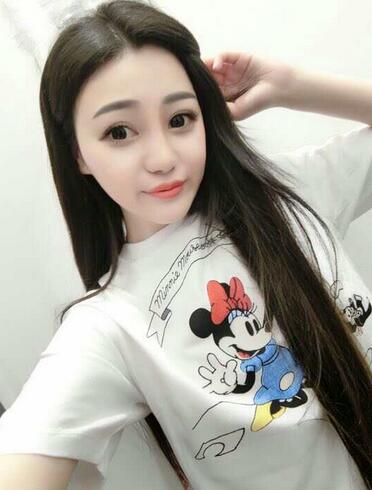 上海九院李圣利隆鼻整形真實恢復期圖片