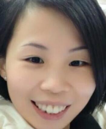 牙齒矯正的很好的年齡，多對比圖真實案例分享——成都格林口腔