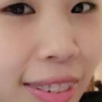 牙齒矯正的適宜年齡，多對比圖真實案例分享——成都格林口