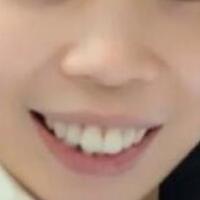 牙齒矯正的適宜年齡，多對比圖真實案例分享——成都格林口