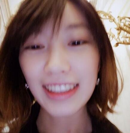 牙齒矯正前后對(duì)比圖，成人牙齒矯正費(fèi)用9800元——成都格林口腔醫(yī)院