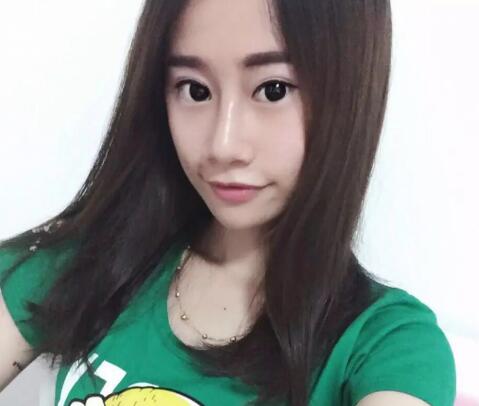 假體隆鼻恢復后果圖