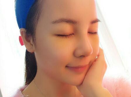 歪鼻子矯正整形恢復(fù)過程和對比圖分享——成都魅麗經(jīng)緯醫(yī)療