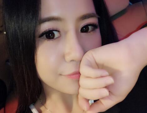 歪鼻子矯正整形恢復(fù)過程和對比圖分享——成都魅麗經(jīng)緯醫(yī)療