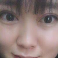 割雙眼皮前后對(duì)比圖和恢復(fù)過(guò)程——成都魅麗經(jīng)緯整形醫(yī)院