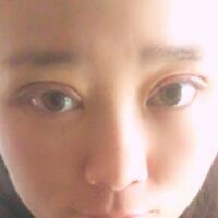 割雙眼皮前后對(duì)比圖和恢復(fù)過(guò)程——成都魅麗經(jīng)緯整形醫(yī)院