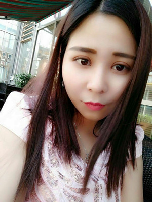 深圳南西子袁新平醫(yī)生做的割雙眼皮+開眼角前后恢復(fù)過程圖片分享