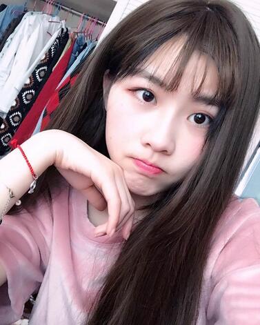 武漢西嬋康美玻尿酸隆鼻恢復(fù)過程圖