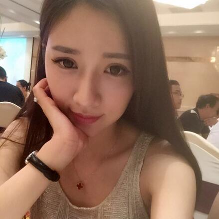 切開雙眼皮恢復(fù)過程分享 杭州東方做雙眼皮2個月