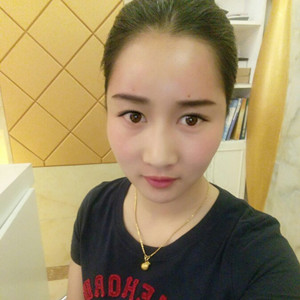 武漢美都張召醫(yī)生做的自體脂肪豐額頭+太陽(yáng)穴，真實(shí)案例分享