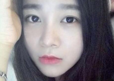 隆鼻整形價格和真實恢復(fù)期圖片