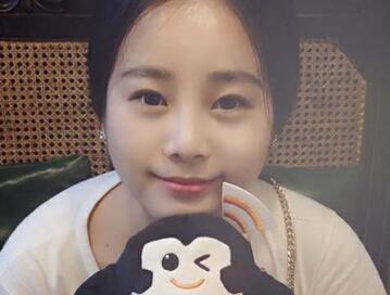 隆鼻整形價格和真實恢復(fù)期圖片