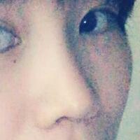 杭州悅可整形醫(yī)院做隆鼻失敗修復(fù)恢復(fù)過(guò)程和對(duì)比圖分享