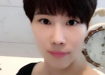 杭州悅可整形醫(yī)院做隆鼻失敗修復(fù)恢復(fù)過(guò)程和對(duì)比圖分享