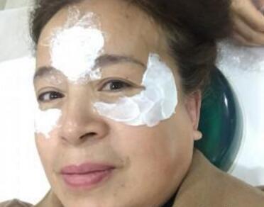 去抬頭紋很好的方法？注射瘦臉去抬頭紋魚尾紋