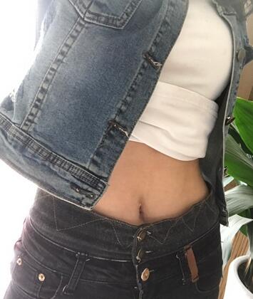 腹部吸脂兩個月親身經(jīng)歷 深圳仁安雅吸脂案例