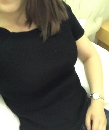 腹部吸脂兩個月親身經(jīng)歷 深圳仁安雅吸脂案例