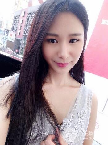 芭比雙眼皮多項整形前后對比照片 青島諾德曹繼武雙眼皮案例