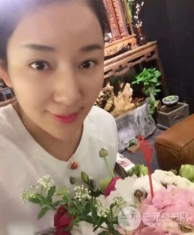 全臉線D圖片 線D恢復過程圖片