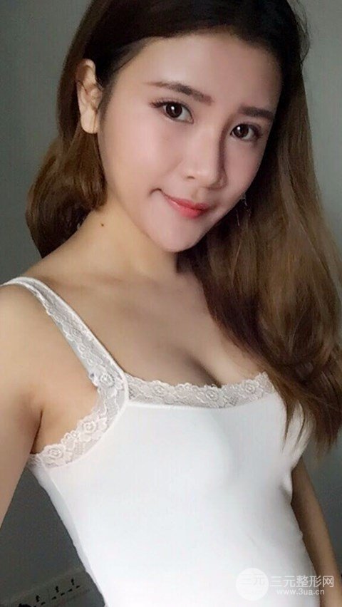 淄博陽光整形自體脂肪隆胸前后對比圖，真實案例