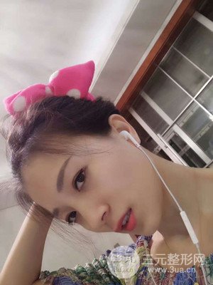 分享我的激光祛眼袋手術(shù)前后過程，廈門思明安黛美林韻醫(yī)生做的